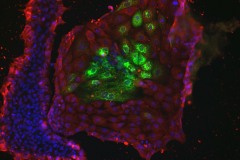 iPS cell Spontaneous differentiation (fluorescence)