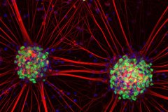 Motor Neurons (fluorescence)